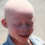 Albino